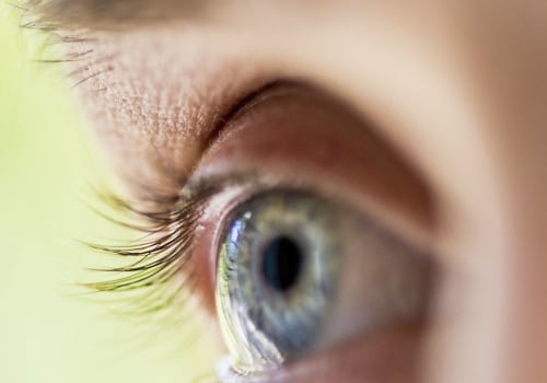 When does insurance cover lasik?